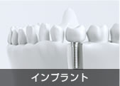 インプラント